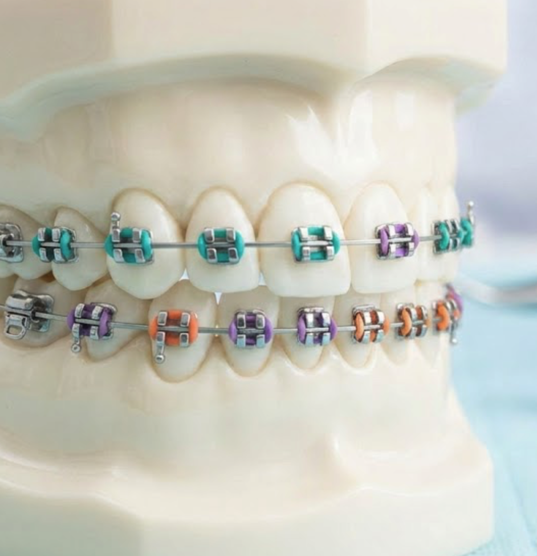 Orthodontics